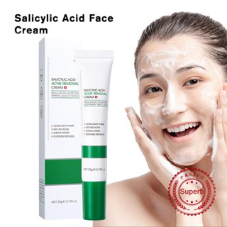 Salicylic Acid ครีมกําจัดสิวเสี้ยน สิวหัวดํา 20 กรัม ซ่อมแซมรอยแผลเป็นจากสิว สิวเสี้ยน ผิวยางลบ U6N6