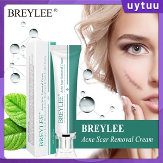 Uytuu Breylee Acne Scar Removal Cream Treatment ลบเครื่องหมายยืด Face Cream Skin Repair รอยแผลเป็นสิว Treatment ลบเครื่องหมายยืด Whitening Cream 30G