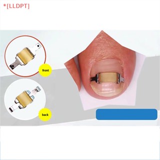 [LLDPT] เครื่องมือรักษาเล็บคุด เล็บเท้า แบบมืออาชีพ