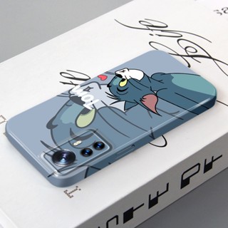 เคสโทรศัพท์มือถือ PC แบบแข็ง ลาย Tom And Jerry สไตล์เกาหลี สําหรับ Xiaomi 12 X Pro S Mi 10 Pro 11 9 Redmi Note 11T Plus POCO F4 X4 GT X3 NFC