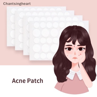 &lt;Chantsingheart&gt; แผ่นแปะสิว ดูดซับ Pus และน้ํามัน ลดราคา