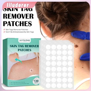 120 ชิ้น/กล่อง Warts Remover Patch ปลอดภัยไม่เจ็บปวดแท็ก Patches Pimple Wart Treatment Patch Fast Acting Remover Wart HO