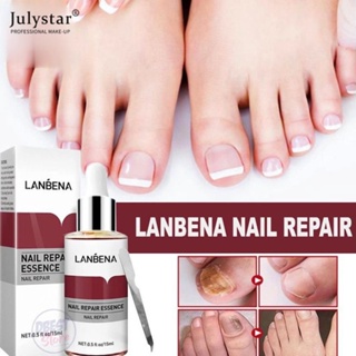 JULYSTAR Lanbena Fungal Nail Repair Essence Serum Treatment Care เจลกำจัดเชื้อราที่เล็บเท้าป้องกันการติดเชื้อ Paronychia Onychomycosis