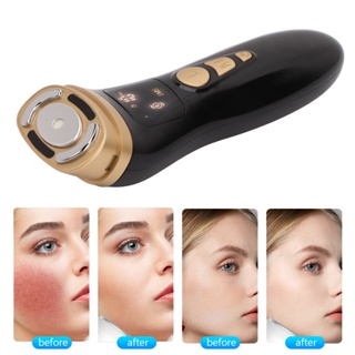 Mother &amp; Baby RF Mini Face LED Machine 5 Gears Color Light Warm Up Microcurrent Wrinkle Removal Beauty Device for Eye 100-240V