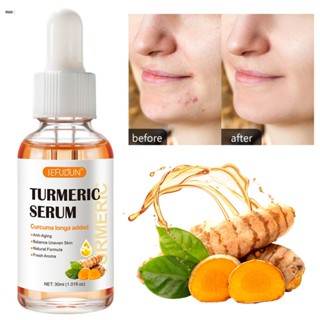 Sefudun Turmeric Essential Oil Moisturizing Moisturizing Facial Brightening Skin Facial Lifting Wrinkle Turmeric Essence nuuo