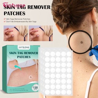 Jaysuing 120pcs Wart Remover Acne Pimple Patches Skin Tag Remover Patches Mole Wart Removing Sticker ส่วนผสมจากธรรมชาติ Skin Tag Remover [TOP]