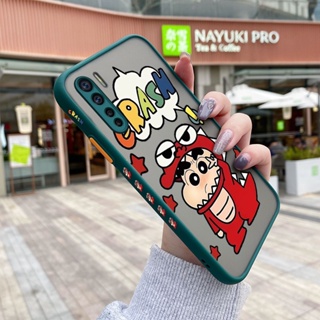 เคสซิลิโคนใส ขอบสี่เหลี่ยม กันกระแทก ลายการ์ตูนชินจัง สําหรับ OPPO A91 F15 Reno 3 4G