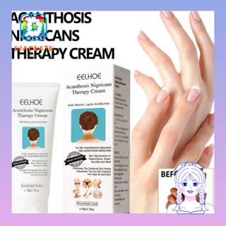 Diachath Nigricans Therapy Cream 50g ครีมรักษาจุดด่างดํา ครีมบํารุงผิวกาย ครีมปรับจุดด่างดํา