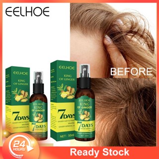 【COD】 Eelhoe 30/50Ml Ginger Hair Growth Spray น้ำมันหอมระเหย Anti Hair Loss Products Prevent Hair Dry Damaged Thinning Scalp Treatment For Men Women