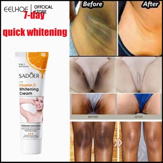 SADOER miss v Private Part Bleaching Cream Vitamin C Underarm Whitening Healthy Remove Melanin Knee Arm Body Lotion 50g -eelhoe