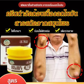 ครีมกําจัดไขมัน (กําจัด lipoma ใน 7 วัน), การขยายไฟเบอร์โรม่าใต้ผิวหนัง, มวลไขมัน