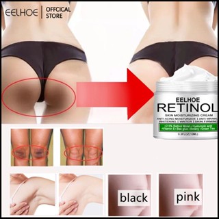 EELHOE Retinol Cream Whitening To Remove Melanin Brightening Cream Fairy Skin Original For Private Parts Body Underarm Neck 50Ml M03-Eelhoe