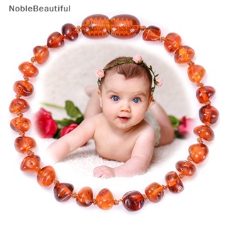 [NobleBeautiful] สร้อยข้อมือ สีเหลืองอําพัน อําพัน เครื่องประดับ สําหรับผู้หญิง [TH]