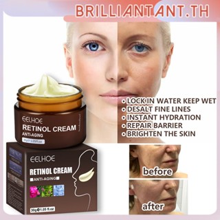 Eelhoe Retinol Face Cream Anti-aging ลบริ้วรอยกระชับยกกระชับ Whitening Brightening Moisturizing Firming Lifting Facial Skin Care bri