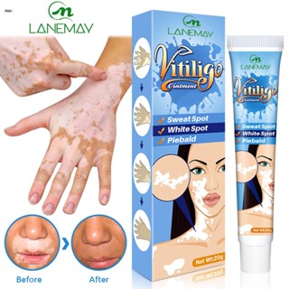 Lanemay White Spot Cream Sweat Spot White Spot Skin Topical Cream Spot Care Repair Cream นูโอ