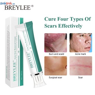 Breylee Scar Remover Cream กำจัดเมลานินเก่าและใหม่ Scar Treatment Scar Repair Stretch Marks Removal Scar Removal Cream Acne Treatment Scar Fade 30g/box Linklink