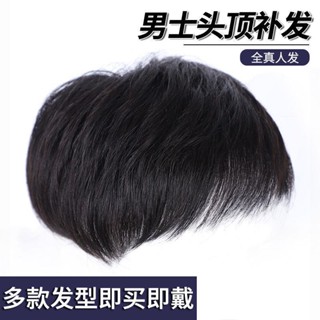 Spot second hair# wig mens short hair head patch full real hair broken hair covering white hair additional amount mens head patch 8cc