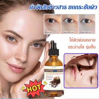 [1/2Pcs]อายเอสเซนส์เพื่อขจัดอนุภาคไขมัน 30mlกำจัดเม็ดไขมัน อายครีม เซรั่มรอบดวงตา ลดเม็ดไขมัน