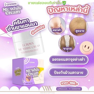 สุดฮิต!! ครีมทาง่ามขา แอนนา I CROWN ME WHITE CREAM ครีมทาจุดซ้อนเร้น รักแร้ ขาหนีบ ข้อศอก หัวเข่า ที่ดำด้าน ศอก