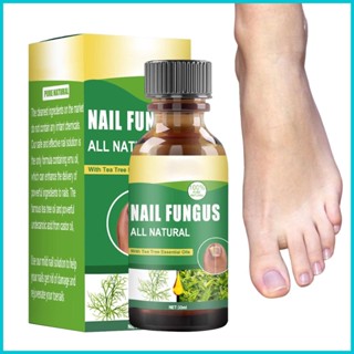 Toenail Fungu ทรีตเมนต์บํารุงเล็บ ซ่อมแซมเล็บ ฟื้นฟูเล็บให้แข็งแรง 30 มล.