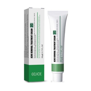 Acne and freckle Cream Removes facial acne, melasma and dark spots, brightens the face and improves dullness