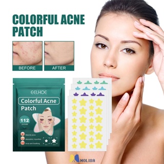 EELHOE 112แพทช์กันน้ำPatch Treatment Skin Care Repair Oxy Pimple Clear Fit Master Patch Star MOLISA