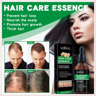 Eelhoe Ginger Hair Care Essence ลดผมร่วง กระตุ้นการเจริญเติบโตของเส้นผม บำรุง ให้ความชุ่มชื้นแก่หนังศีรษะ ควบคุมความมัน Essence Hair Care 30ml JOYFEEL