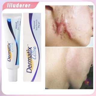 ของแท้ Usa Dermatix Ultra Scar Advance 15g สูตรเจลกำจัดสิวซ่อมแซมผิวดูแลผิวรักษาสิว Keloids ลบยืด HO