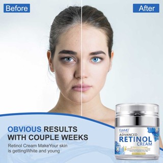 Retinol Face Cream Vitamin A Anti Aging Anti Wrinkles Acne Moisturizer