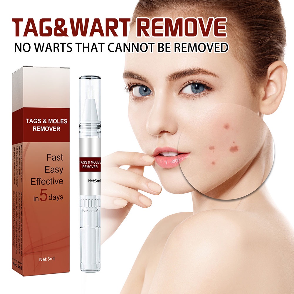 Warts & Moles ปากกากําจัดหูด มีประสิทธิภาพ สําหรับหูดขนาดเล็ก