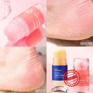 Vaseline ครีมบํารุงผิวมือ และส้นเท้า ให้ความชุ่มชื้น ป้องกันการแห้งแตก O0W4