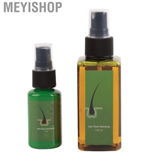 Meyishop Hair Ginger 30ml Green  120ml Prevent Loss Men&amp;apos;s And Women&amp;apos;s