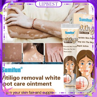 ♕ Sumifun Vitiligo Cream Remove White Spot Ringworm Localized Leukoplakia Disease Treatment Antibacterial Ointment Natural Herbal Extract For Body Care UPBEST