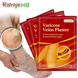 Kanyehb 6 ชิ้นเส้นเลือดขอด Patch พลาสเตอร์สติกเกอร์ส่งเสริมการไหลเวียนโลหิตขอด Vein Healing Patch [TOP]