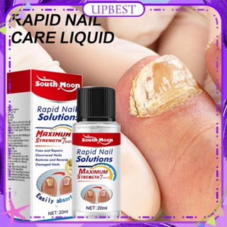 ♕ South Moon Rapid Nail Solution Care Anti Fungal Relieves Cracking Scratches Moisturizing Foot Skin Essence Natural Herbal Treatment Foot Body Care 20ml UPBEST