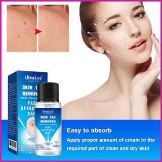 ผลิตภัณฑ์ดูแลผิวหน้า น้ํายากําจัดหูด จากธรรมชาติ สําหรับ Warts Moles Corns on Contact kiodth