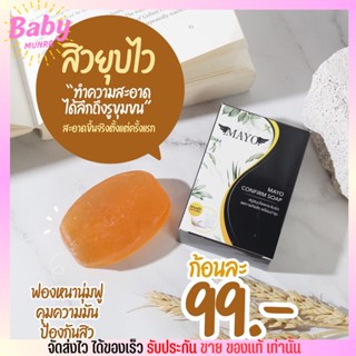 สิวลดตั้งแต่ก้อนแรก 🚩 สบู่ เมโย กระชับรูขุมขน หน้าขาวใส Mayo soap สุมนไพร ลดหน้ามัน