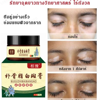 ครีมบำรุงจุดขาว Baoyu ช่วยกระตุ้นเม็ดสีดำ สำหรับผิวหน้าและร่างกาย