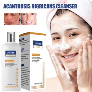 Skinenjoy Cleansing Lotion for Acne &amp; Spots &amp; Acanthosis Nigricans for All Skin