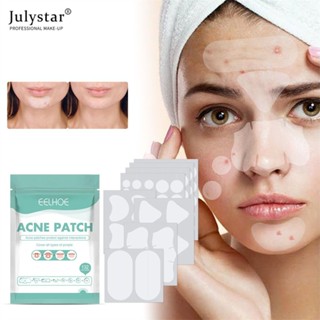 JULYSTAR Acne Mask Patch Fade Imprint Patch Acne Repair Veneer Care ผลิตภัณฑ์