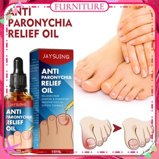 ♕ Jaysuing Anti Paronychia Relief Oil Repair Embedded Nail Thickening Grey Nail Relief Pain Ditch Soothing Care Oil Nail Care 10ml FURNITURE