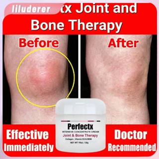 Perfectx Joint Bone Collagen Cream For Joint Bone Pain Relief Correction Correction Relieve Joint Pain 30g โฮ