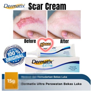 CYREAL Cod Dermatix Scar Gel Acne Scar Remover Acne Scars Treatment Old Scar Removal นำเข้าที่มีประสิทธิภาพ -15g