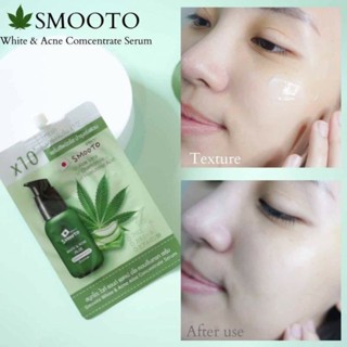 ❤️❤️ (6 ซอง/กล่อง) เซรั่ม อัพผิวใส กู้หน้าสิว Smooto  White &amp; Acne Aloe Concentrate Serum 6ml