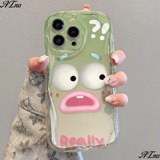 ✅เคสโทรศัพท์มือถือแบบนิ่ม ใส กันกระแทก ลายตลก สําหรับ Iphone 7 12 1413 8p xrเคสป้องกัน สําหรับ Apple 11promax Xs N17A