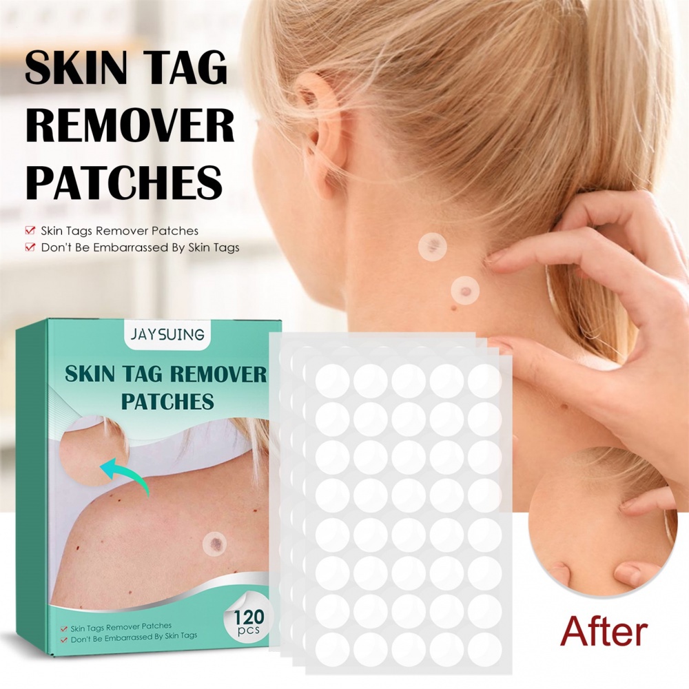 120 ชิ้น/กล่อง Warts Remover Patch ปลอดภัยไม่เจ็บปวดผิวแท็กแพทช์สิว Wart Treatment Patch Fast Acting Remover Warts Moles ส่วนผสมธรรมชาติสําหรับผิวทั้งหมด