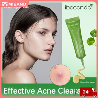 คลังสินค้าพร้อม Ibcccndc Acne Cream Herbal Face Care Fade Acne Marks To Remove Blackheads Acne To Repair Women Students Acne Cream 15g