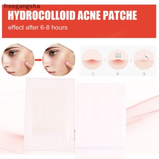 [FREG] 24Pcs UV Discoloration Acne Removal Patch Beauty Acne Tools Face Spot Scar Care Stickers Pimple Acne Concealer Hydrocolloid FDH