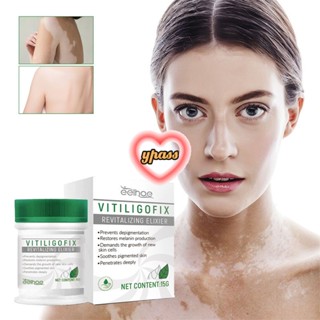 CYREAL CYREAL Eelhoe White Spot Disease Treatment Ointment Leukoplakia Disease Repair Cream Vitiligo Chinese Medical Pigment เมลานินบาล์มดูแลผิว