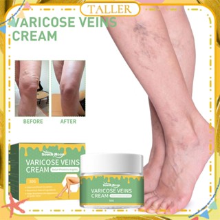 ✧Ready Stcok South Moon Vein Repair Cream Leg Massage Relief Pain Repair Earthworm Leg Vein Care Cream Natural Ingredient Treatment Body Care 50g TALLER